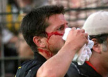 Ketelaers Check brach Plaßhenrich die Nase